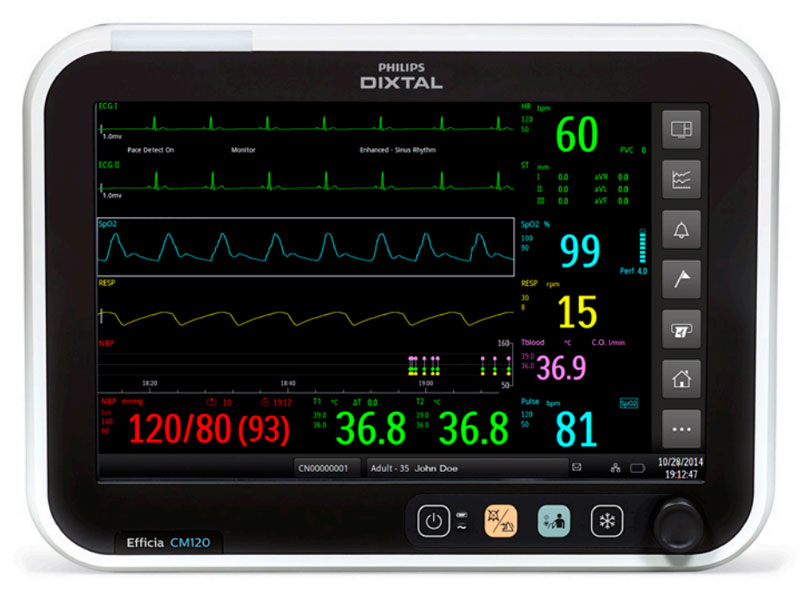 Monitor Multiparâmetro Philips Efficia CM 120 | TecHealth - Tecnologia ...